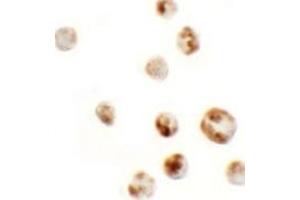 Immunohistochemistry (IHC) image for anti-Actin Filament Associated Protein 1-Like 1 (AFAP1L1) (N-Term) antibody (ABIN1031218) (AFAP1L1 Antikörper  (N-Term))