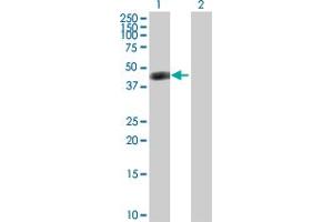 Western Blot analysis of ASL expression in transfected 293T cell line by ASL MaxPab polyclonal antibody. (ASL Antikörper  (AA 1-464))