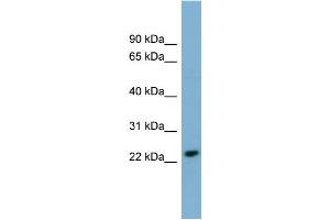 WB Suggested Anti-KLRC3 Antibody Titration:  0. (KLRC3 Antikörper  (N-Term))
