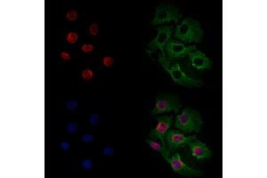 ABIN6261598 and ABIN6266535 staining Hela cells by IF/ICC. (ERK1/2 Antikörper)