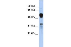 WB Suggested Anti-MVK Antibody Titration: 0. (MVK Antikörper  (Middle Region))