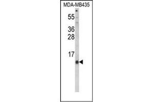 Western blot analysis of Hepcidin / HAMP Antibody (Center) in MDA-MB435 cell line lysates (35ug/lane). (Hepcidin Antikörper  (Middle Region))