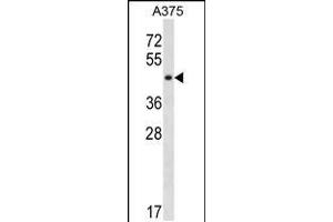 Western blot analysis in A375 cell line lysates (35ug/lane). (SUGT1 Antikörper  (C-Term))
