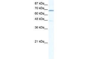 WB Suggested Anti-CACNB2 Antibody Titration:  0. (CACNB2 Antikörper  (C-Term))