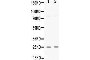Western Blotting (WB) image for anti-Thymidine Kinase 1, Soluble (TK1) (AA 2-234) antibody (ABIN3042478) (TK1 Antikörper  (AA 2-234))