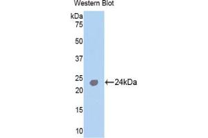 Western blot analysis of the recombinant protein. (TNNI1 Antikörper  (AA 1-187))