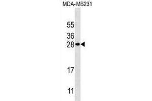 Western Blotting (WB) image for anti-Kallikrein 7 (KLK7) antibody (ABIN3002617) (Kallikrein 7 Antikörper)