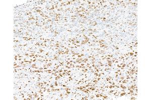 Immunohistochemistry (IHC) image for anti-Promyelocytic Leukemia (PML) (AA 375-425) antibody (ABIN7454722) (PML Antikörper  (AA 375-425))