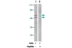 Western blot analysis of extracts from K-562 cells treated with H 2 O 2  (100 uM, 30 mins), using LYN polyclonal antibody . (CD180 Antikörper)
