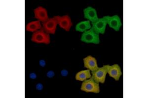 Caspase 8 Mouse Monoclonal Antibody staining Hela cells by IF/ICC. (Caspase 8 Antikörper)