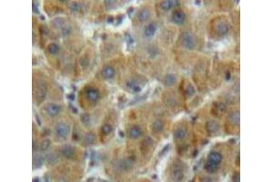 IHC-P analysis of Liver tissue, with DAB staining. (ALDH7A1 Antikörper  (AA 29-539))