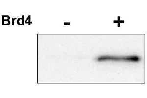 Western blot using  affinity purified anti-CDK9 pT29 antibody shows detection of phosphorylated CDK9. (CDK9 Antikörper  (pThr29))