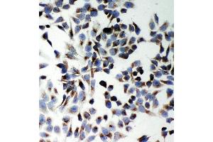 Anti-SQSTM1/p62 antibody, ICC ICC: Hela Cell (SQSTM1 Antikörper  (N-Term))