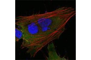 Confocal immunofluorescence analysis of HepG2 cells using MCL1 antibody (green). (MCL-1 Antikörper)