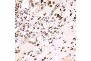 Immunohistochemistry (Paraffin-embedded Sections) (IHC (p)) image for anti-CCAAT/enhancer Binding Protein (C/EBP), gamma (CEBPG) (AA 1-150) antibody (ABIN6138388)