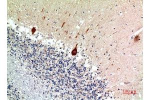 Immunohistochemical analysis of paraffin-embedded human-brain, antibody was diluted at 1:100 (Nodal Antikörper  (C-Term))