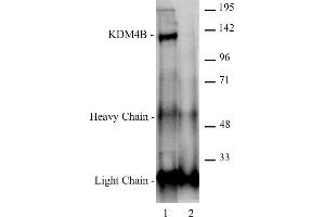 JMJD2B / KDM4B antibody (pAb) tested by Immunoprecipitation. (KDM4B Antikörper  (C-Term))