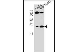 RHOJ Antibody (Center) (ABIN655708 and ABIN2845159) western blot analysis in HepG2,MDA-M cell line lysates (35 μg/lane). (RHOJ Antikörper  (AA 131-159))