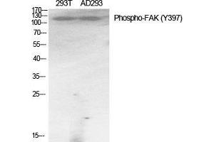 Western Blot (WB) analysis of specific cells using Phospho-FAK (Y397) Polyclonal Antibody. (FAK Antikörper  (pTyr397))