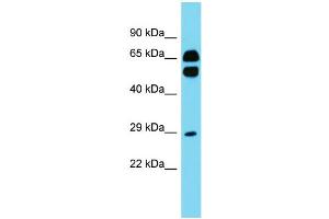 Host: Rabbit Target Name: CD200R1L Sample Type: Fetal Heart lysates Antibody Dilution: 1. (CD200R1L Antikörper  (N-Term))