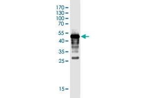 Western Blot detection against Immunogen (44. (FLJ35767 (AA 1-164) Antikörper)