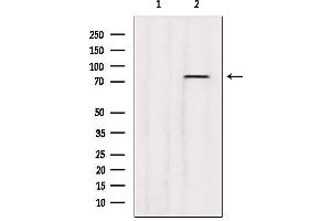 Western blot analysis of extracts from B16F10, using ABCD3 Antibody. (CX3CL1 Antikörper  (C-Term))