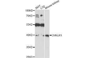 Western blot analysis of extracts of various cell lines, using CMKLR1 antibody (ABIN6291865) at 1:1000 dilution. (CMKLR1 Antikörper)