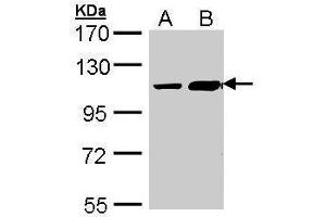 WB Image Sample (30 ug of whole cell lysate) A: Hep G2 , B: Molt-4 , 7. (TRAK2 Antikörper  (C-Term))