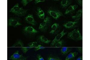 Immunofluorescence analysis of U-2 OS cells using Polyclonal AntibodyPC1 Polyclonal Antibody at dilution of 1:100 (40x lens). (PC1 Antikörper)
