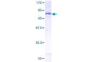 Image no. 1 for Fumarate Hydratase (FH) (AA 33-510) protein (GST tag) (ABIN1354068) (FH Protein (AA 33-510) (GST tag))