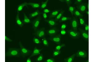 Immunofluorescence analysis of A549 cells using APTX antibody (ABIN5973100). (Aprataxin Antikörper)