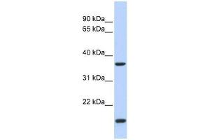 ZIC4 antibody used at 0. (ZIC4 Antikörper  (N-Term))