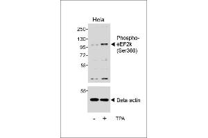 Western blot analysis of lysates from Hela cell line, untreated or treated with T, 200nM, using (ABIN6241062 and ABIN6578958) (upper) or Beta-actin (lower). (EEF2K Antikörper  (pSer366))