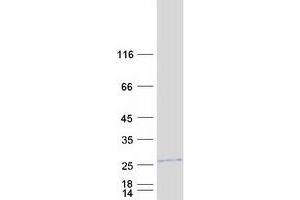 Validation with Western Blot