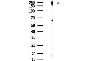 Western blot analysis of lysates from COLO205 cells(LPS, 4h treatment), using Mupp1 Antibody at 1/1000 dilution.