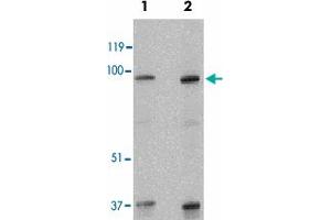 Western blot analysis of SKI in human kidney tissue lysate with SKI polyclonal antibody  at 1 and 2 ug/mL . (SKI Antikörper  (N-Term))