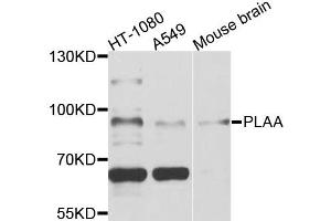 Western blot analysis of extracts of various cell lines, using PLAA antibody (ABIN5972403) at 1/1000 dilution.