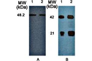 (A) Western blot analysis of mammalian cell extracts, HeLa (lane 1) and HEK (lane 2) using anti-IKKγ pAb . (IKBKG Antikörper  (AA 40-210))