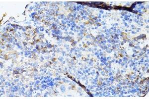 Immunohistochemistry of paraffin-embedded Mouse spleen using TEFM Polyclonal Antibody at dilution of 1:100 (40x lens). (TEFM Antikörper)