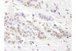 Immunohistochemistry (IHC) image for anti-Transcription Elongation Factor B (SIII), Polypeptide 2 (18kDa, Elongin B) (TCEB2) (AA 68-118) antibody (ABIN7453458)