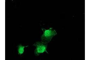Anti-ZFAND2B mouse monoclonal antibody (ABIN2454250) immunofluorescent staining of COS7 cells transiently transfected by pCMV6-ENTRY ZFAND2B (RC203822). (ZFAND2B Antikörper)