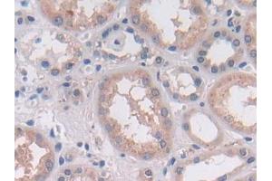 DAB staining on IHC-P; Samples: Human Kidney Tissue (OAS2 Antikörper  (AA 11-346))