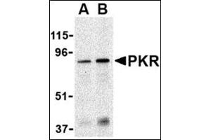Western blot analysis of PKR in Caco-2 whole cell lysate with this product at (A) 1 and (B) 2 μg/ml. (EIF2AK2 Antikörper  (N-Term))