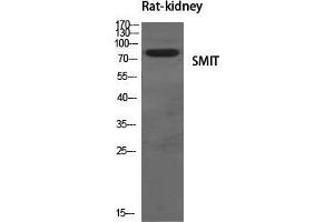 Western Blot (WB) analysis of specific cells using SMIT Polyclonal Antibody.