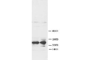 Anti-FGF8 antibody, Western blottingWB: Rat Ovary Tissue Lysate
