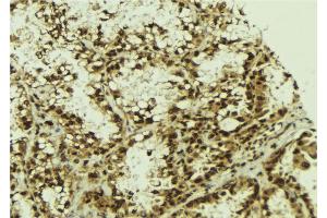 ABIN6273273 at 1/100 staining Human lung tissue by IHC-P. (NFKBIZ Antikörper  (Internal Region))