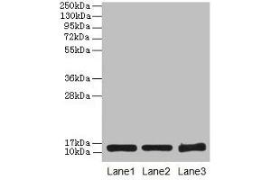 Western blot All lanes: SNCG antibody at 16 μg/mL Lane 1: HT29 whole cell lysate Lane 2: Mouse brain tissue Lane 3: 293T whole cell lysate Secondary Goat polyclonal to rabbit IgG at 1/10000 dilution Predicted band size: 14 kDa Observed band size: 14 kDa (SNCG Antikörper  (AA 1-127))