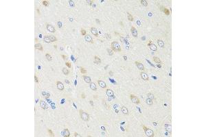 Immunohistochemistry of paraffin-embedded rat brain using CRABP2 antibody. (CRABP2 Antikörper  (AA 22-94))