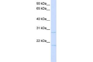 WB Suggested Anti-TCF21 Antibody Titration:  0. (TCF21 Antikörper  (C-Term))