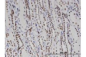 Image no. 1 for anti-DEAD/H (Asp-Glu-Ala-Asp/His) Box Polypeptide 11 (DDX11) (AA 1-970) antibody (ABIN599369) (DDX11 Antikörper  (AA 1-970))